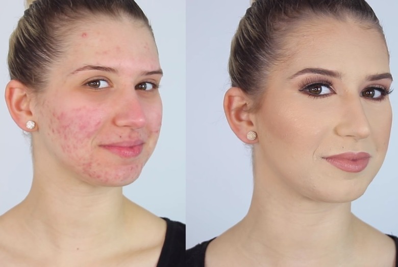 Como maquilhar um rosto com acne?